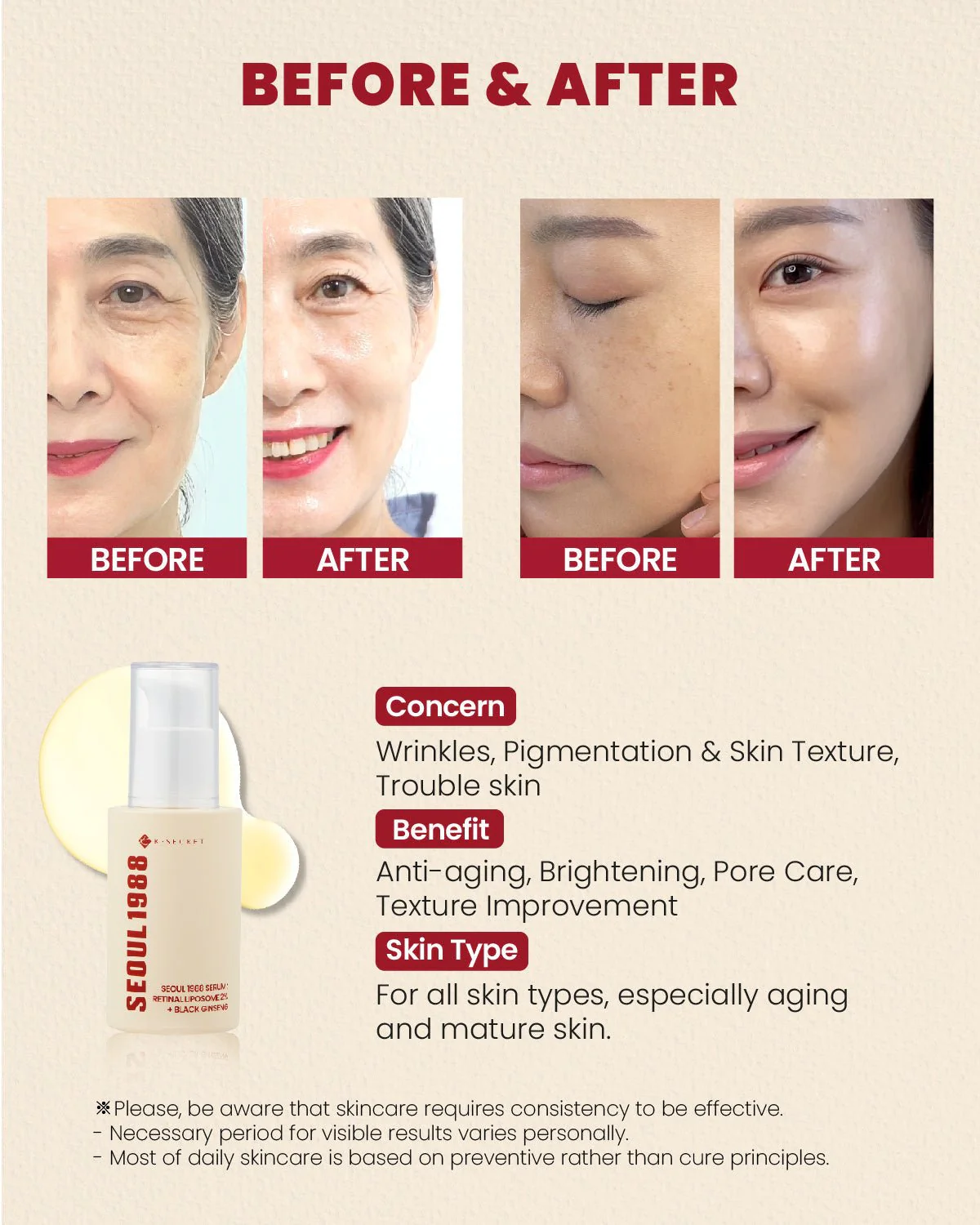 SEOUL 1988 Serum Retinal Liposome 2% + Black Ginseng 30ml - Image 2