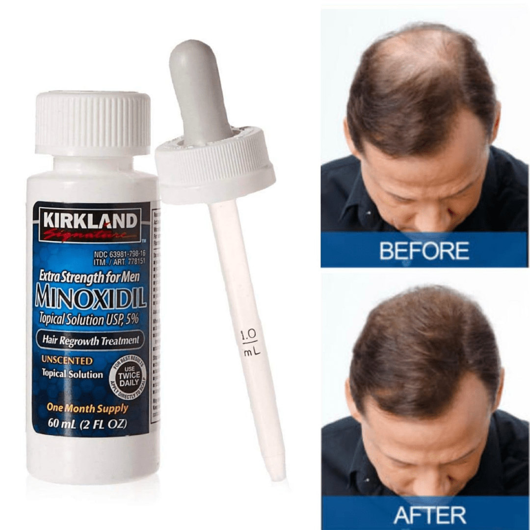 Kirkland Signature Minoxidil Hair Regrowth Treatment (Extra Strength for Men) Single 60ml - Image 3